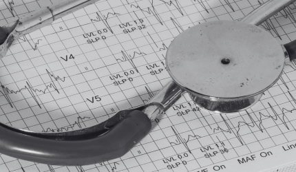 Greve dos peritos do INSS: governo suspende agendas e corta salários dos grevistas